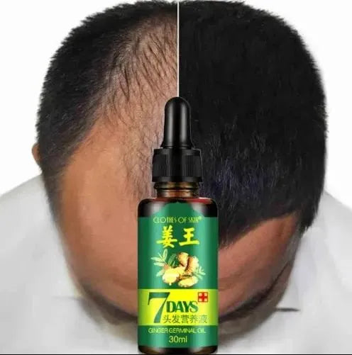**Aichun Beauty AC3058 7 Days Ginger Hair Growth Serum 30ml**
