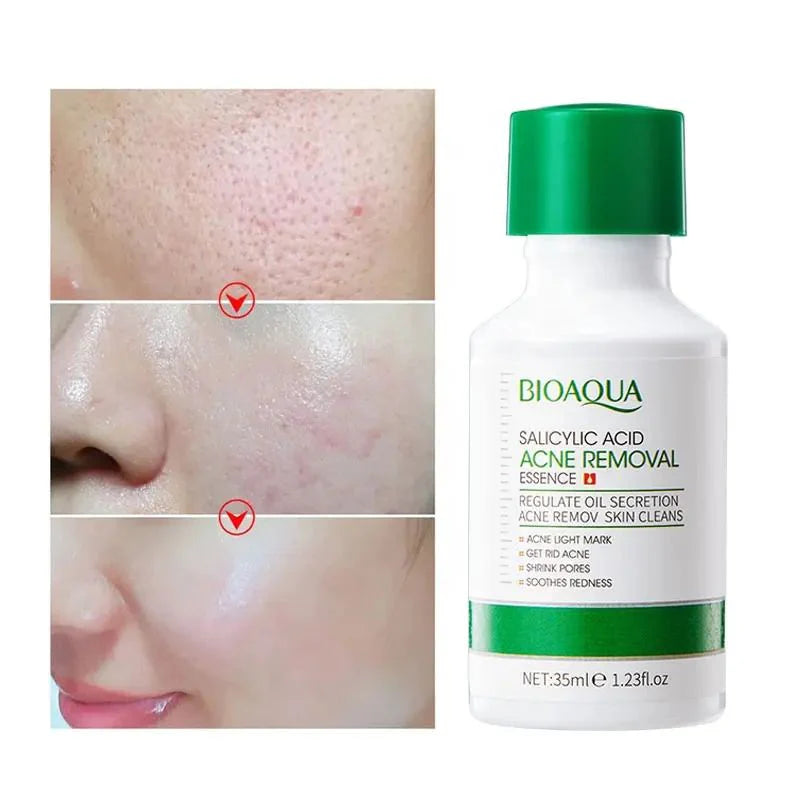 **BIOAQUA BQY49112 Salicylic Acid Acne Control Serum 35ml**
