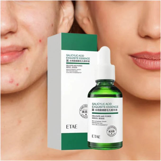 **ETAE Venzen Salicylic Acid Pore Care Face Serum**