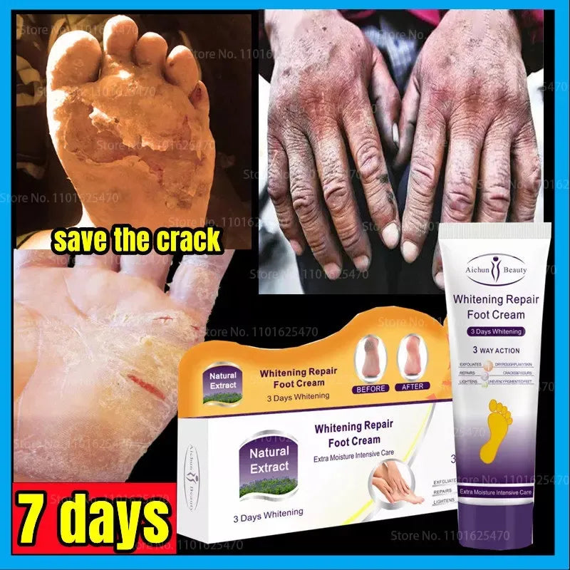 **Aichun Beauty Whitening Foot Cream 100ml**
