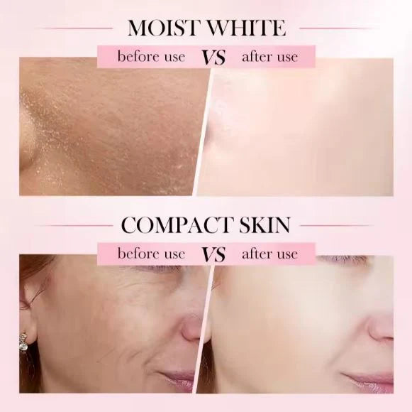 **SADOER Hyaluronic Acid Nicotinamide 4-in-1 Whitening Face Cream**
