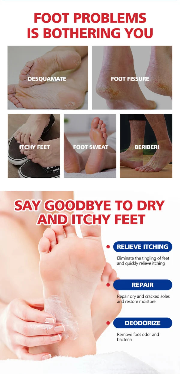 **Aichun Beauty AC2042 Cracked Heel Repair Foot Cream 20g**