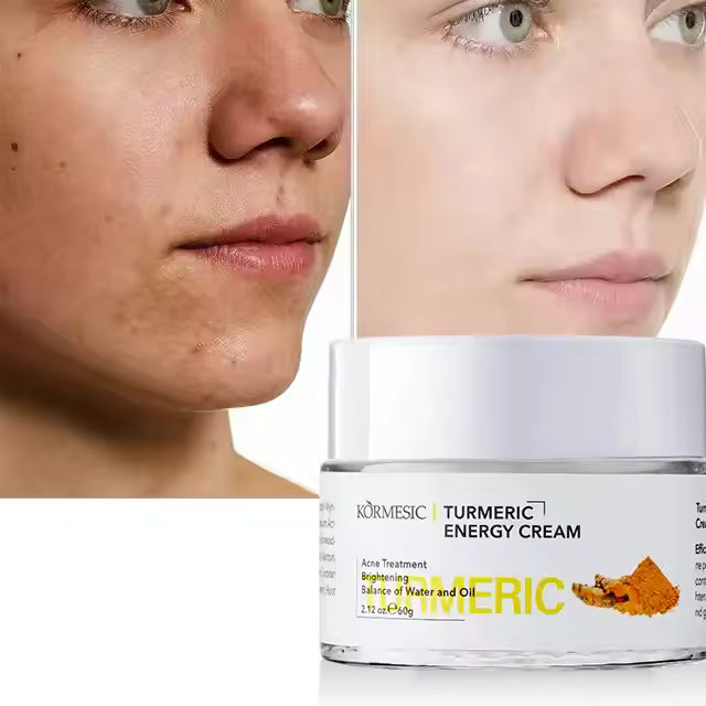 **KORMESIC Turmeric Brightening Face Cream 50g**