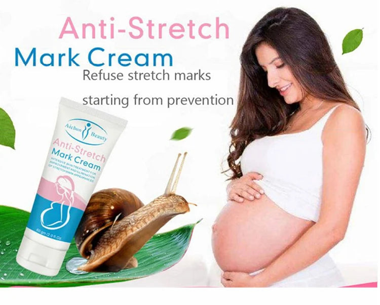 **Aichun Beauty AC227-4 Anti Stretch Mark Cream 60g**