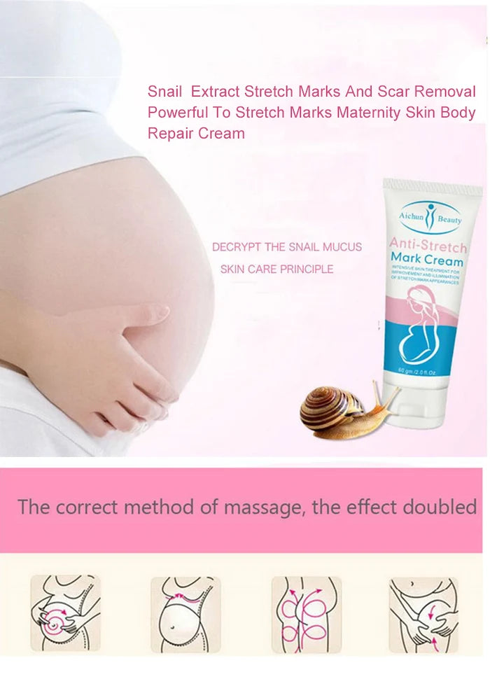 **Aichun Beauty AC227-4 Anti Stretch Mark Cream 60g**