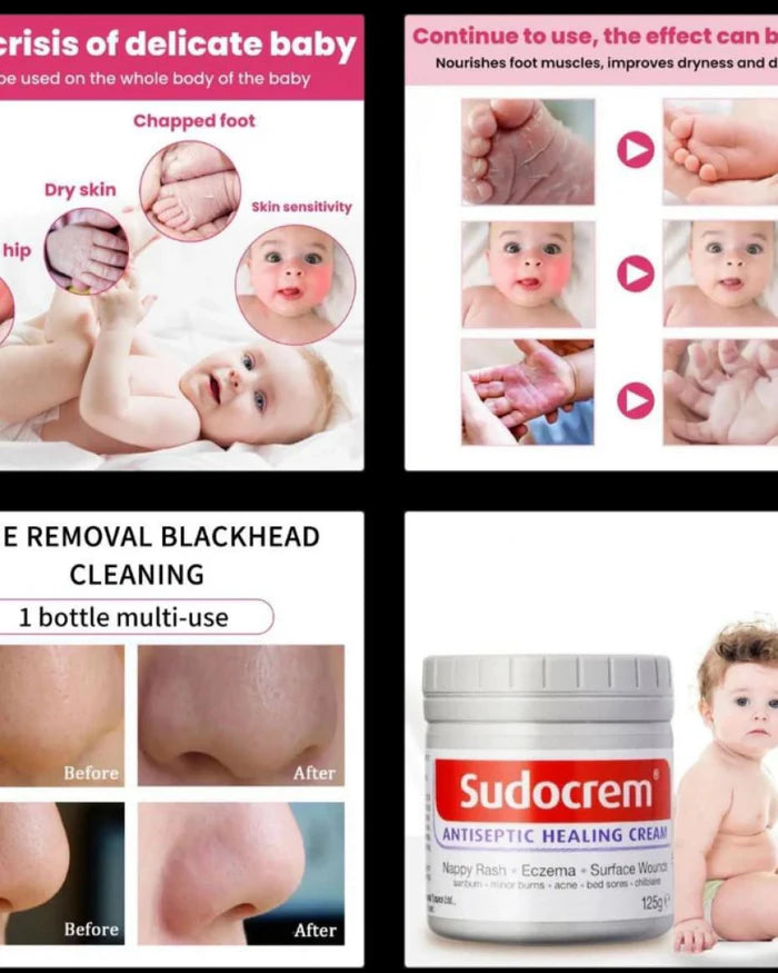 **Miss Beauty Sudocrem Antiseptic Healing Cream**