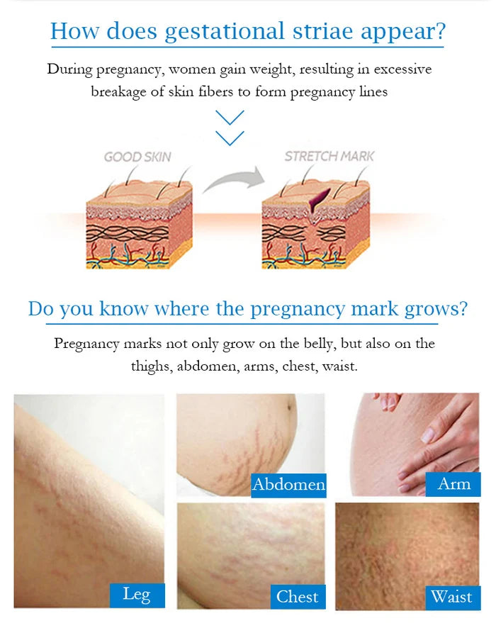 **Guanjing GJ81934 Anti-Stretch Mark Cream 80g**