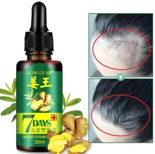 **Aichun Beauty AC3058 7 Days Ginger Hair Growth Serum 30ml**