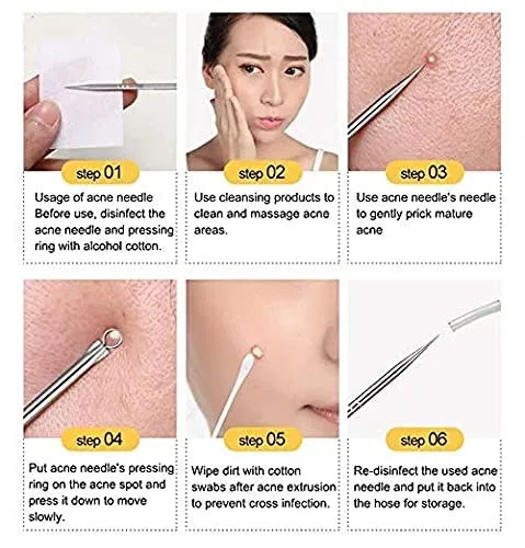 **Blackhead Remover Stainless Steel Extractor Tool**