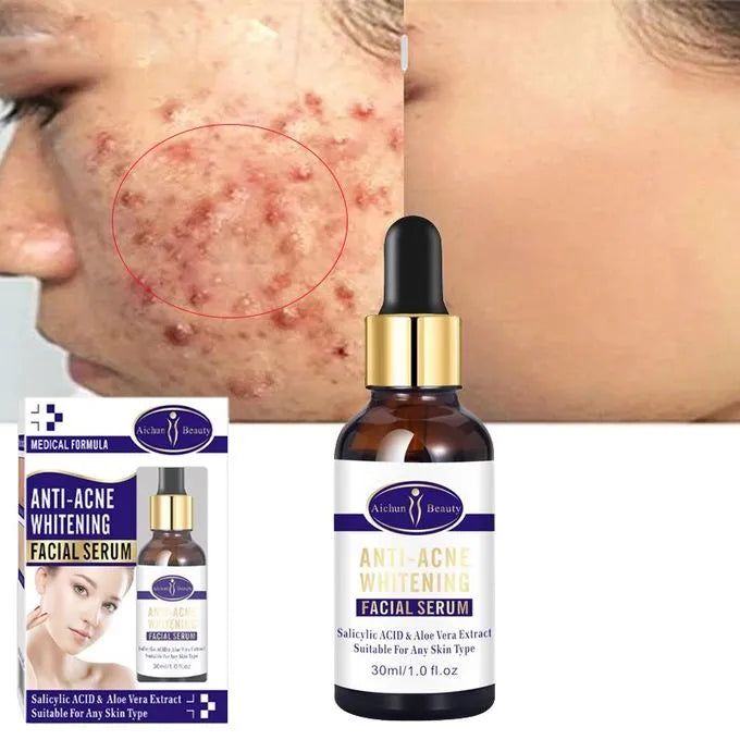 **Aichun Beauty Scar Repair & Glow Facial Serum 30ml**
