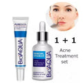 **BIOAQUA Anti-Acne Serum & Scar Cream Set (2PCS)**