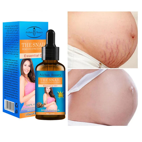 **Aichun Beauty Snail Stretch Mark Essential Oil**