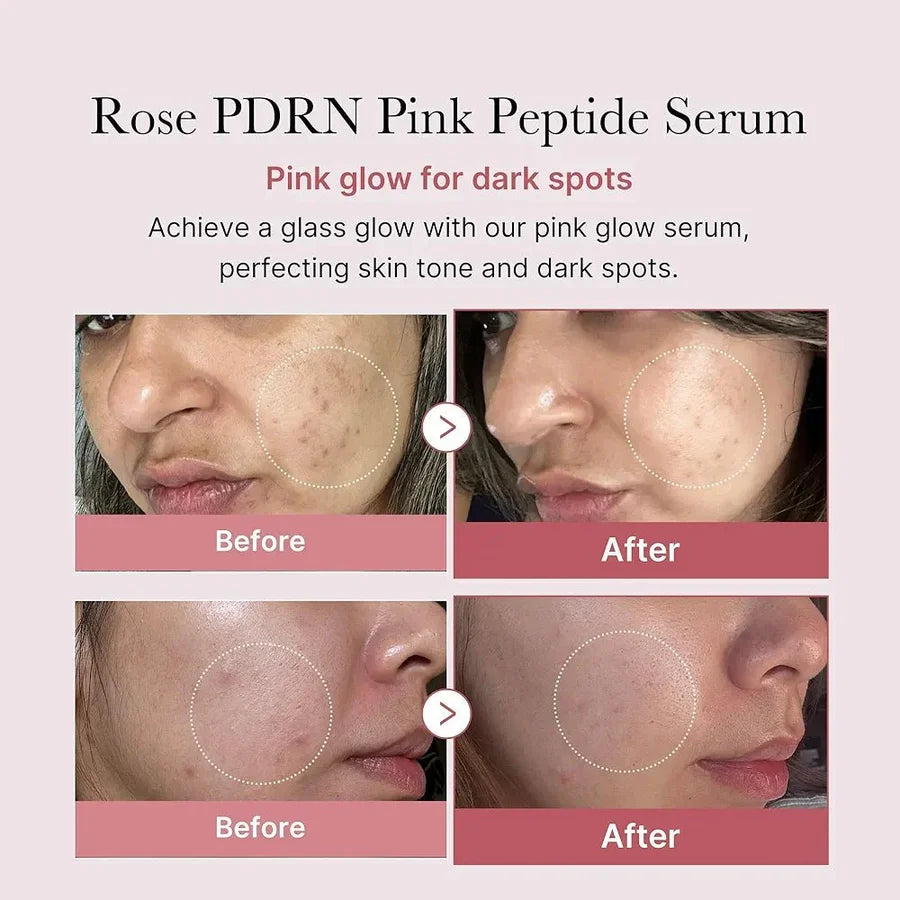 **Medicube PDRN Pink Peptide Repair Serum 30ml**